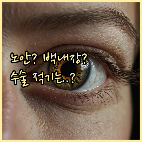 노안과 백내장 차이점 및 수술 적기 ..
