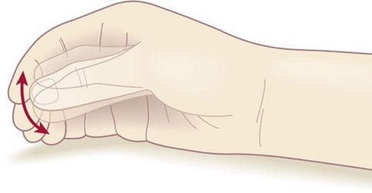 파킨슨병 정부지원 혜택