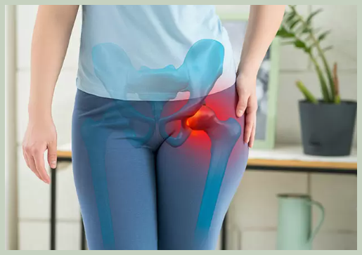 고관절 이상 증상