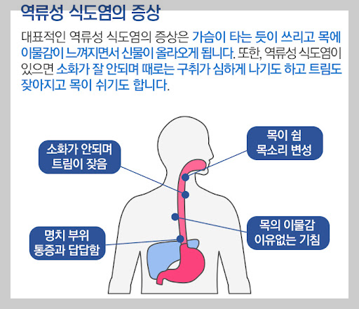 역류성 식도염증상