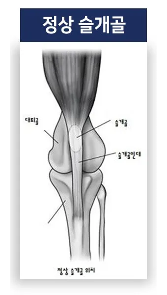 강아지 슬개골 탈구 수술 후유증_9