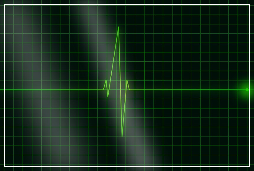 왼쪽 가슴 통증 원인