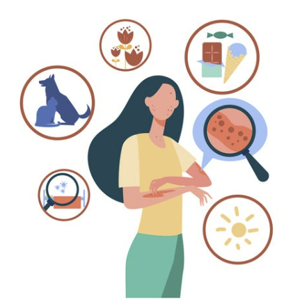 지연성 알러지 검사 증상&amp;#44; 원인&amp;#44; 검사 비용 총정리