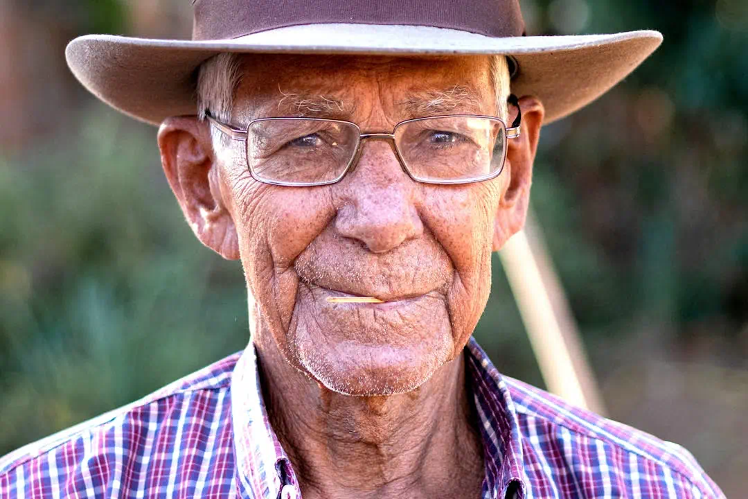 검버섯 가능성이 있는 노인의 모습3