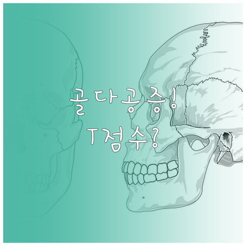 골다공증 진단 기준 T점수, 단계별로..