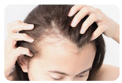 여성 탈모 영양제 추천