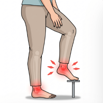 발목 염좌 vs 인대 손상 구분법8