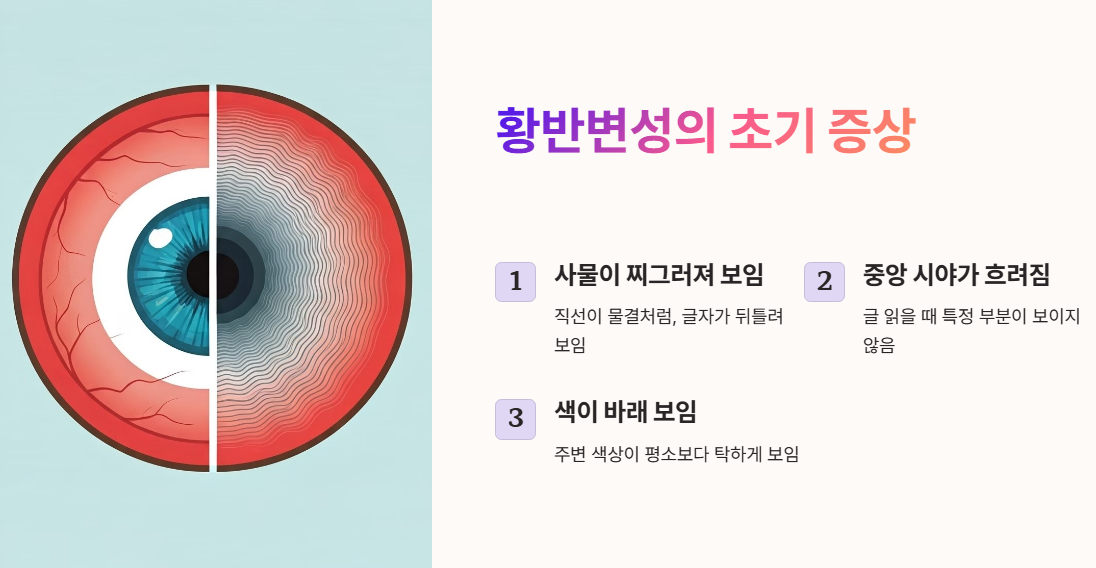 황반변성 초기 증상