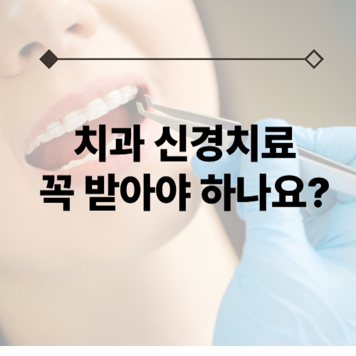 치과 신경치료 꼭 받아야 하는 이유