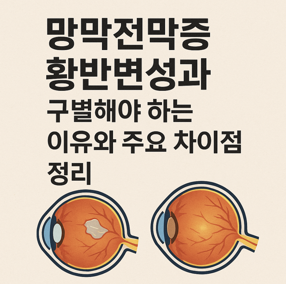 망막전막증 황반변성과 구별해야 하는 이유와 주요 차이점 정리