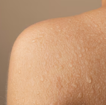 피부가려움증의 원인 10