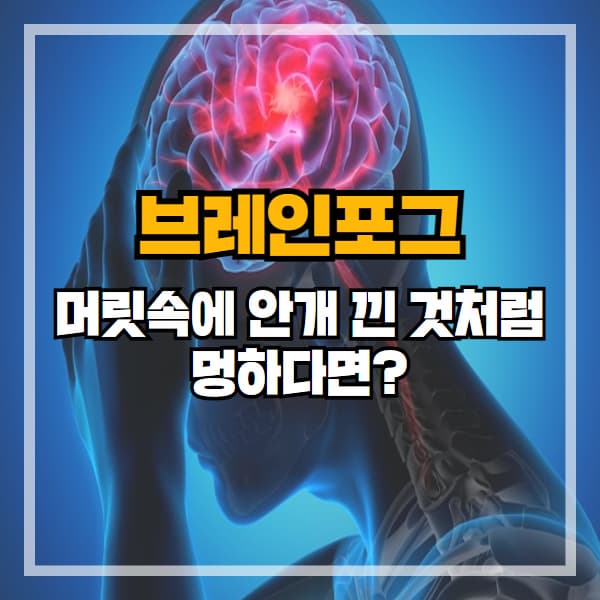 머릿속에 안개 낀 것처럼 멍하다면? 브레인포그 자가진단
