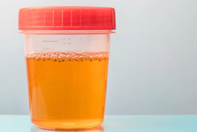 소변 사진/출처:어도비스톡