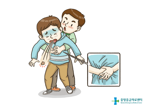 하임리히법이란? 💡