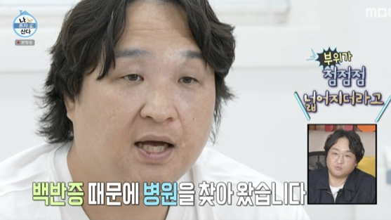 ‘나 혼자 산다’ 구성환의 백반증 투병 이야기