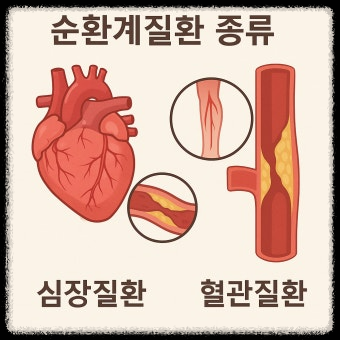 순환계 질환의 모든 것