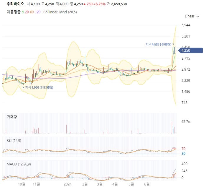 아이큐어 차트