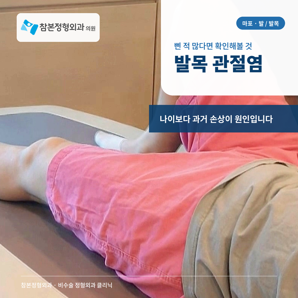 신수동 정형외과 발목 관절염, 삔 적 많다면 확인해볼 것