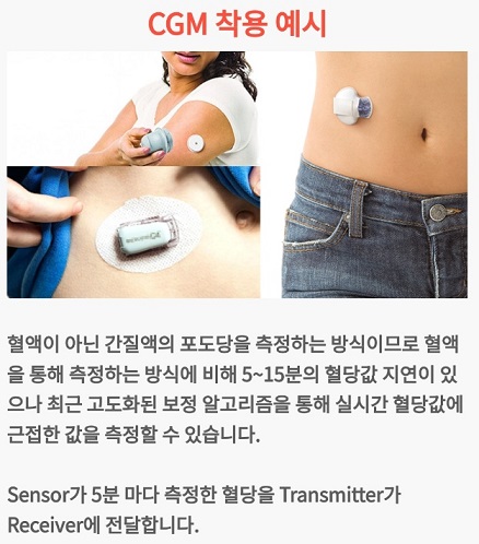 채혈없는혈당측정기