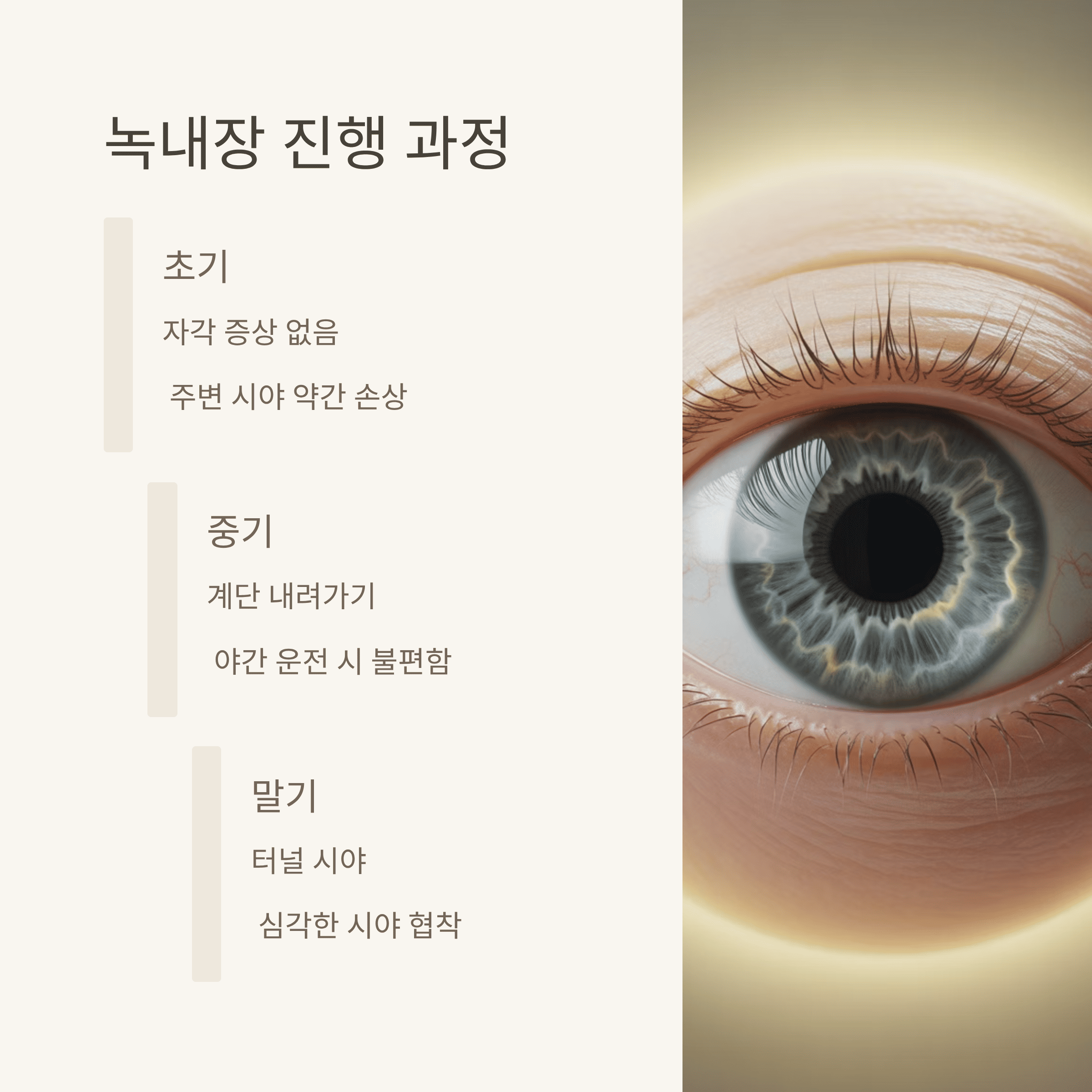녹내장! 놓치면 늦는 시력 도둑의 진실