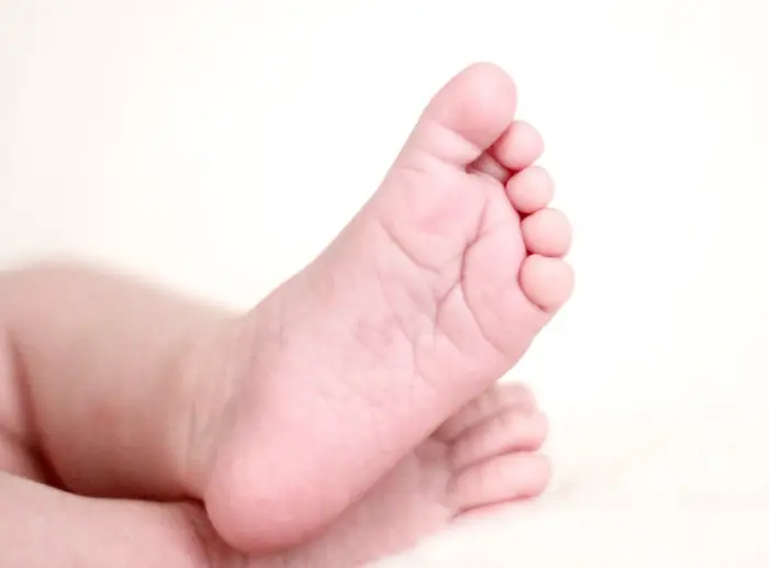 아기 수족구 증상