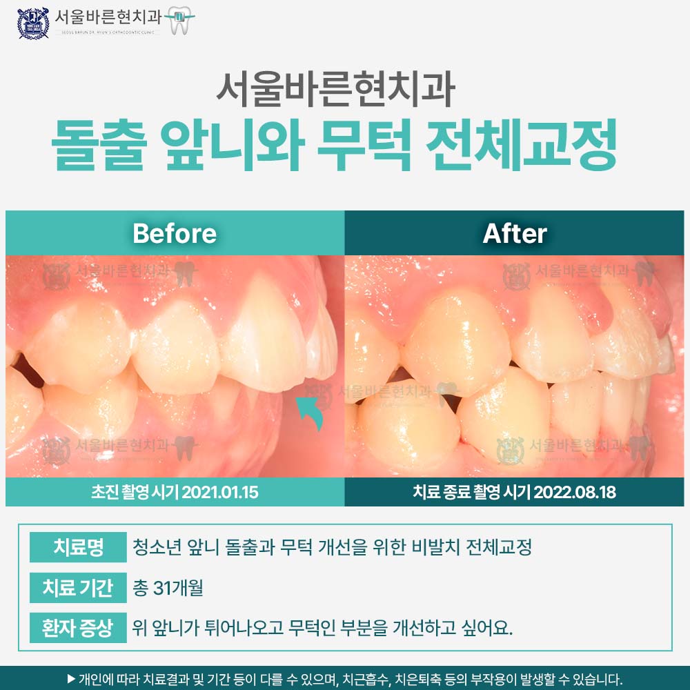 해운대교정치과