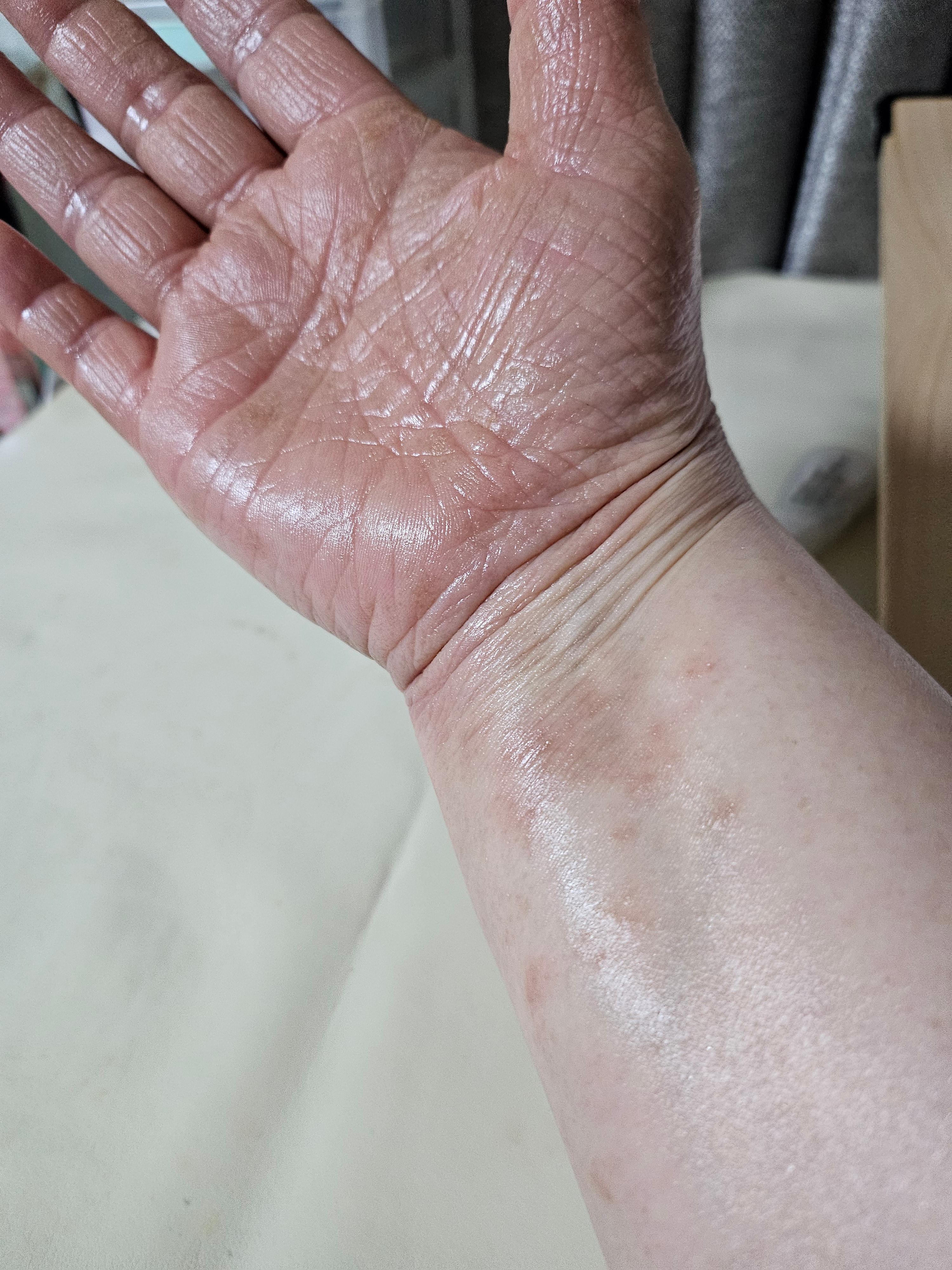 아로마테라피로 촉촉해진 손