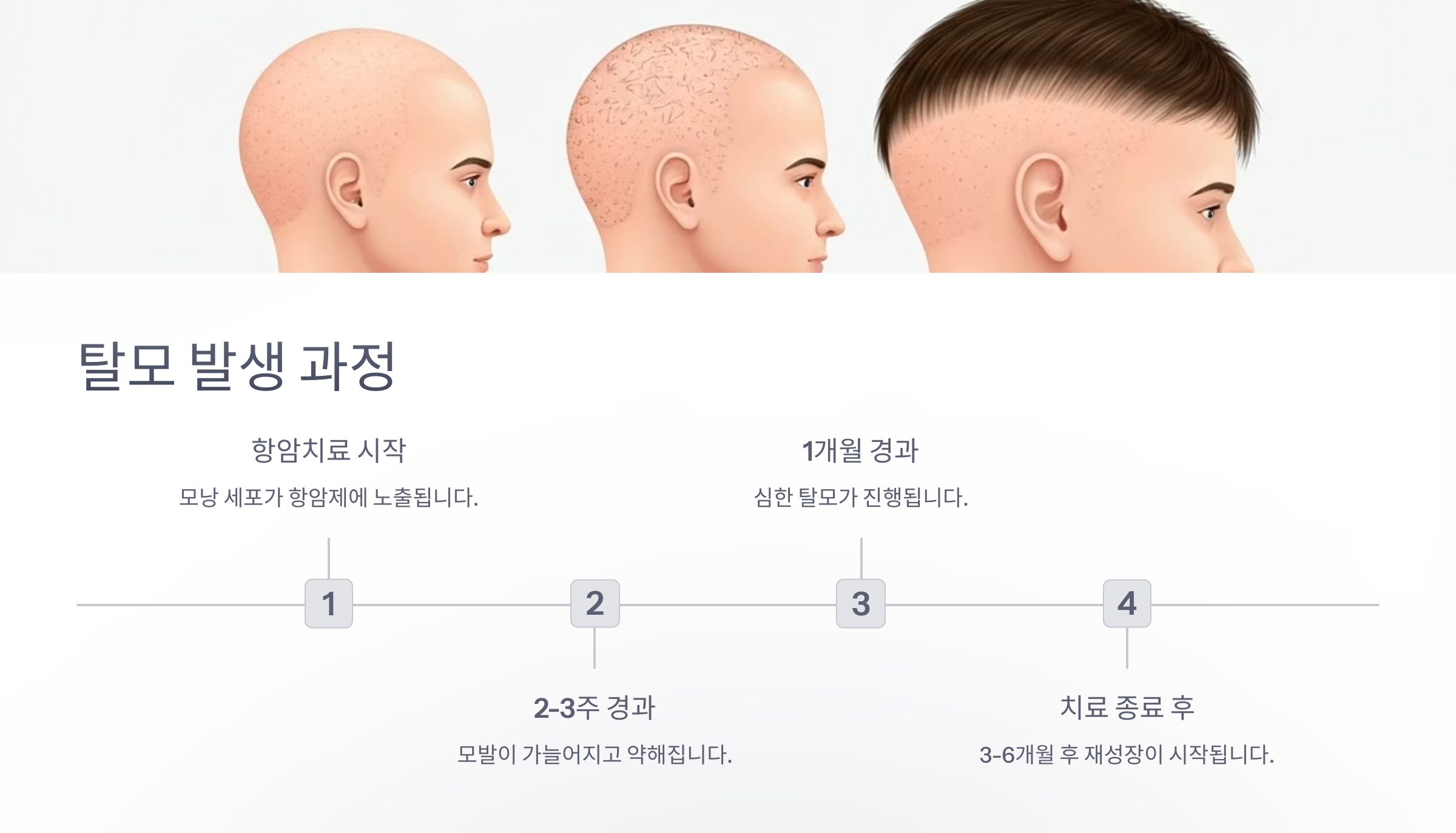 항암치료 탈모 발생 과정