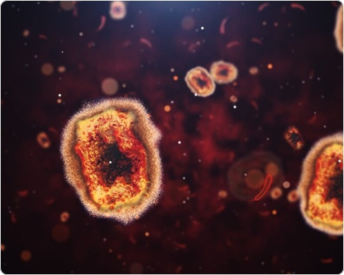엠폭스 증상 및 원인