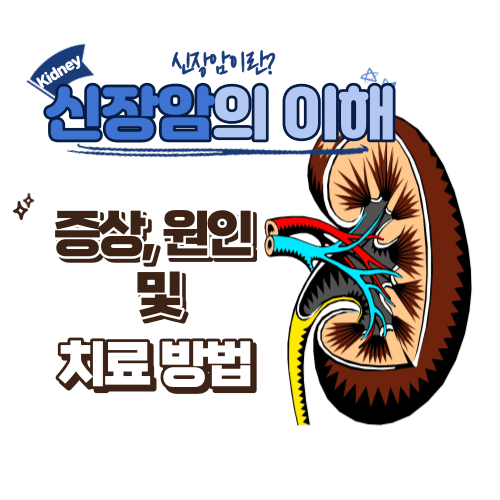 신장암의 이해. 증상, 원인 및 치료 방법.