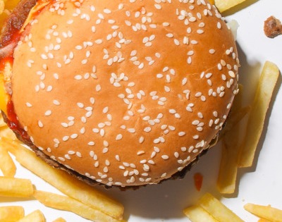 소아 비만 원인