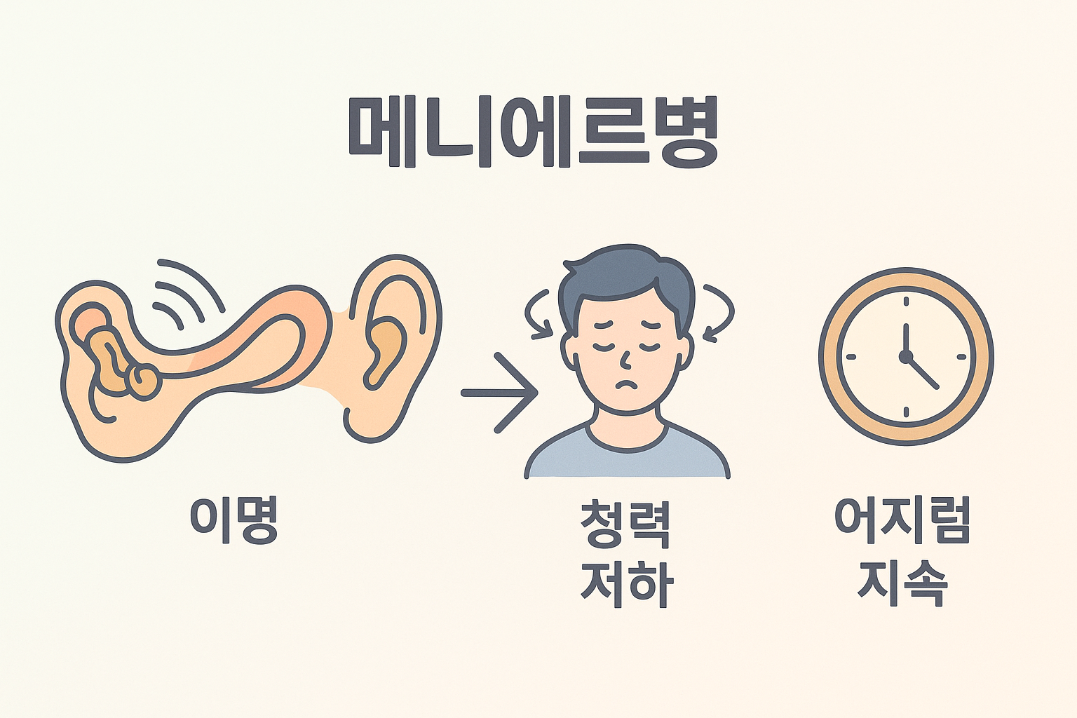 메니에르병은 내림프 과다로 인해 이명, 청력 저하, 어지럼증이 수 시간 지속되는 만성 질환임을 시각적으로 요약한 인포그래픽입니다.