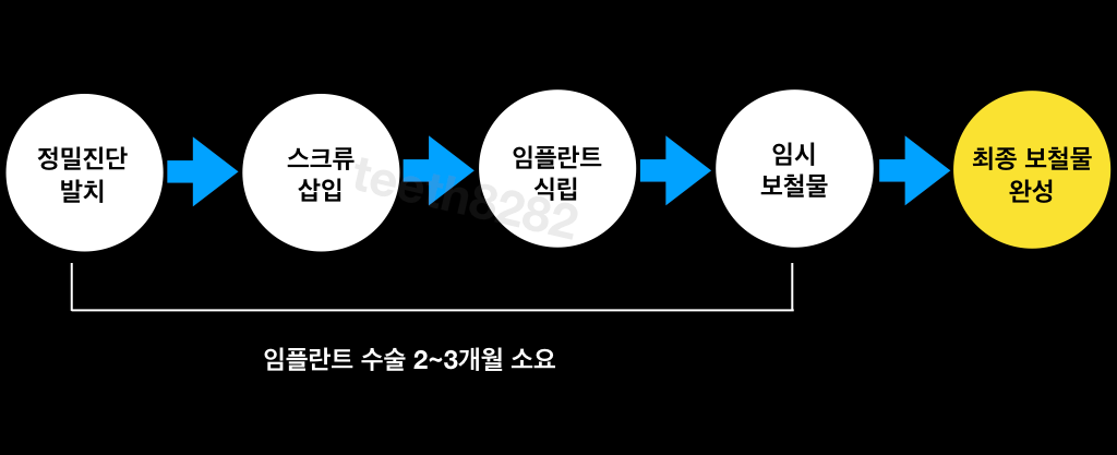 당일-원데이-임플란트-시술과정