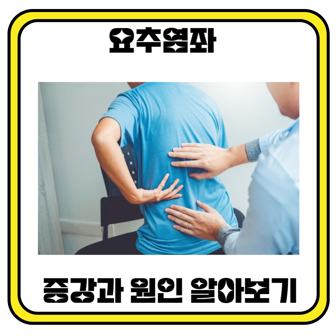 요춤 염좌 증상과 원인