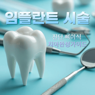 2025 임플란트 시술 과정|진단·뼈이식·치아완성까지 단계별 가이드