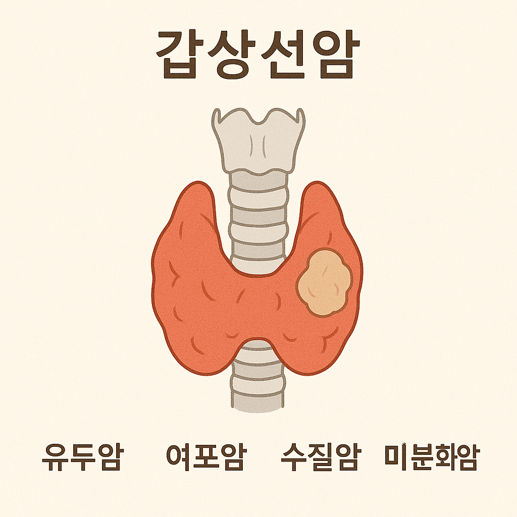 갑상선 암의 진단과 검사를 설명하는 이미지