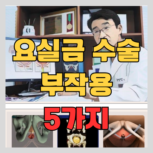 의사가 알려주는 요실금 수술의 부작용 5가지 - 회복기간 | 재수술 하는 이유 썸네일