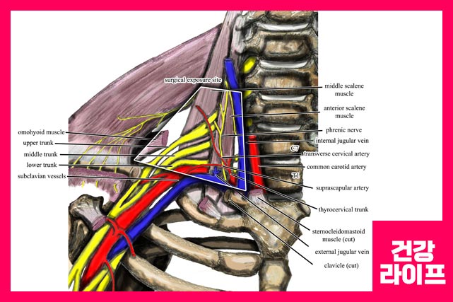왼쪽, 오른쪽 어깨통증