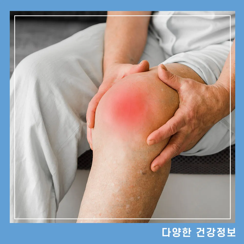 관절염-초기-증상-좋은-음식