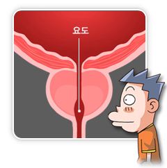 전립선 비대증 원인