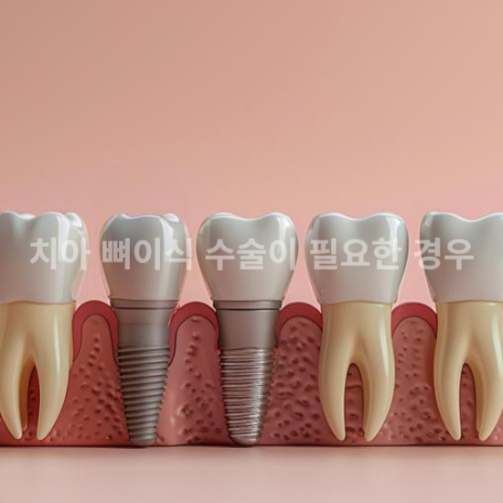 잇몸 뼈