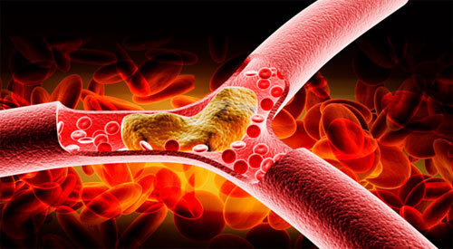 고지혈증에 좋은 과일 8가지