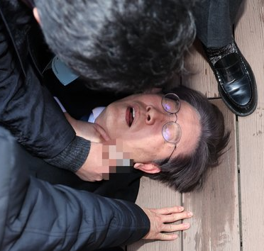 이재명 칼 피습