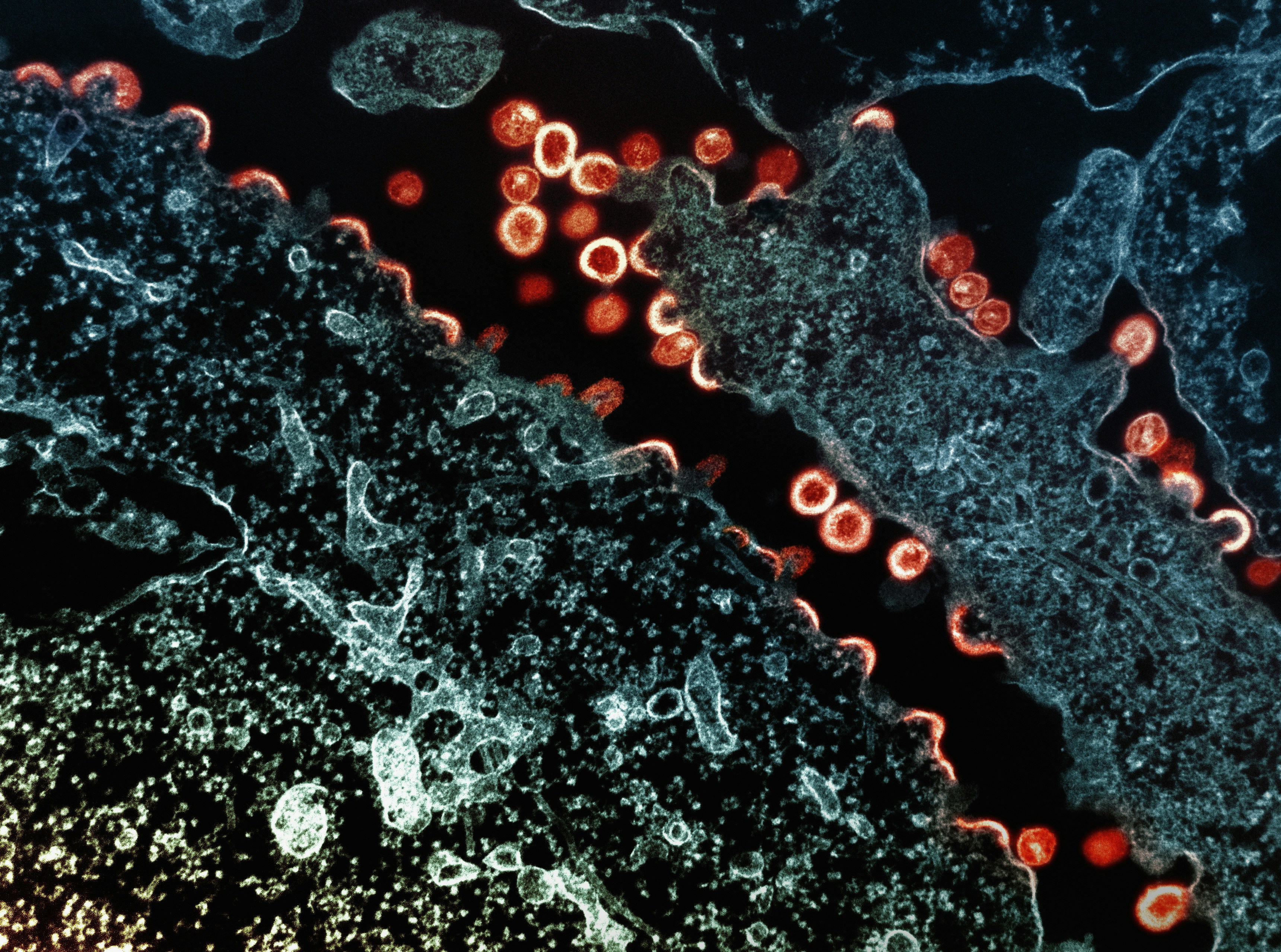 낙산균 6가지 효능 및 유산균과의 차이 (+ 부작용 제품 추천)
