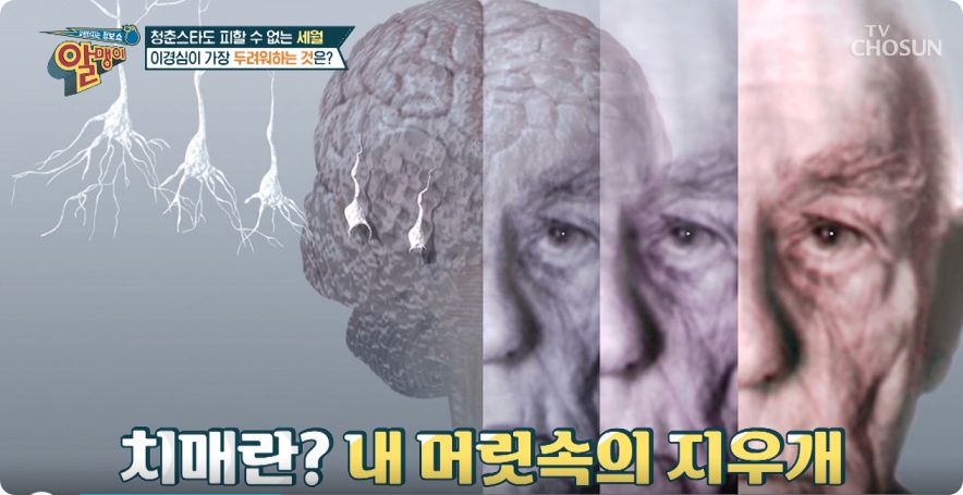 치매-1