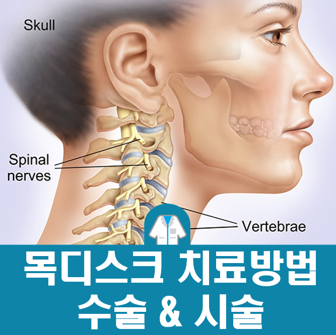 목디스크 치료방법 비교, 수술과 시술 종류