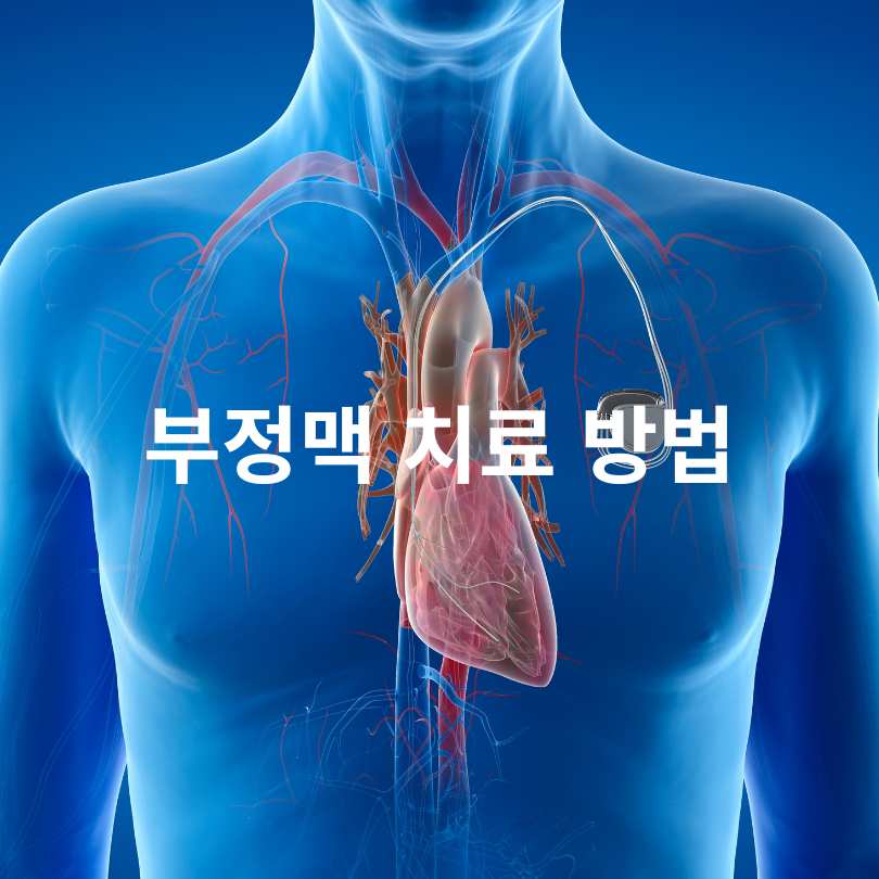 부정맥 증상과 원인&amp;#44; 부정맥 검사와 치료법