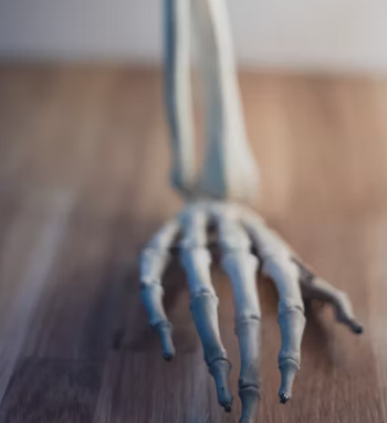 골다공증에 좋은 음식 예방 식단