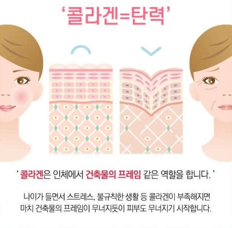 피부 탄력
