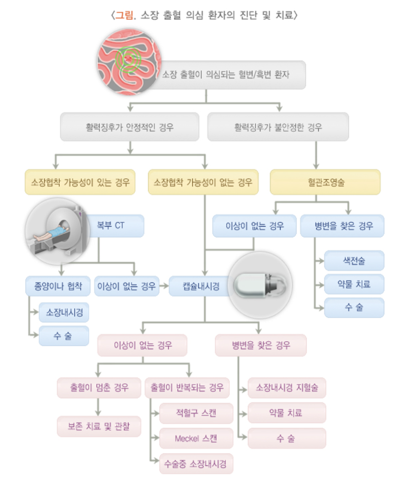 소장 출혈 의심 환자의 치료